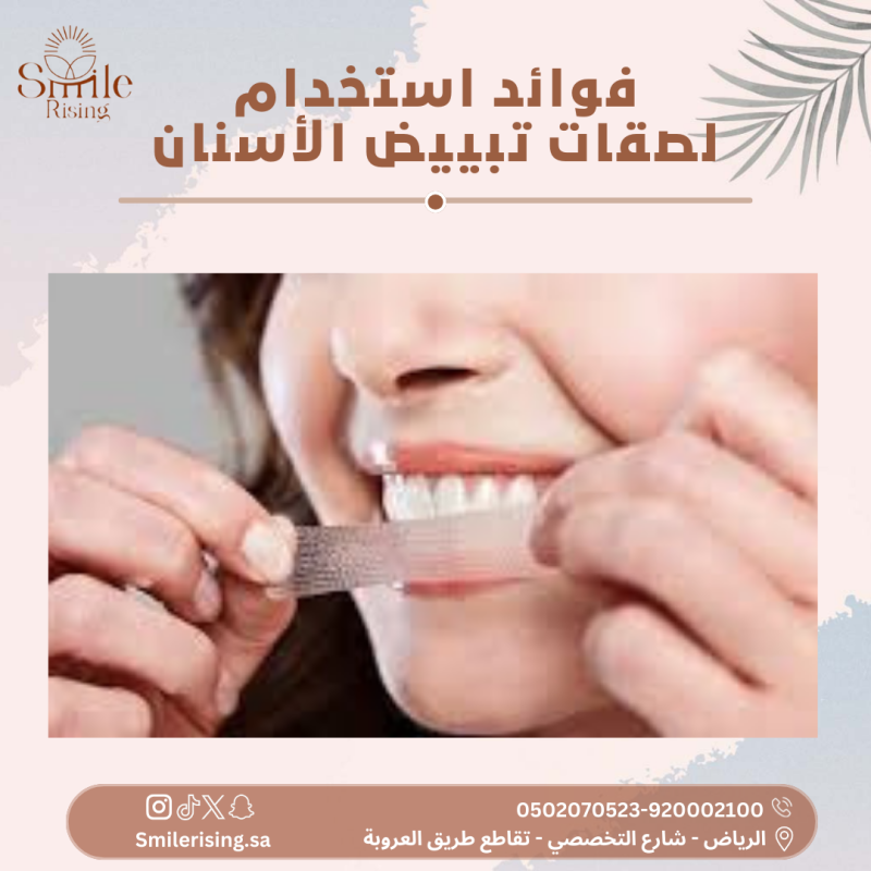 فوائد-استخدام-لصقات-تبييض-الأسنان-800x800.png